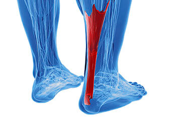 Achilles tendonitis treatment in the Pearland, TX 77584 and Houston, TX 77027, 77074, 77008 areas